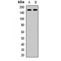 LifeSab™ Kinectin 1 Rabbit pAb (50 µl)