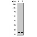 LifeSab™ RBM3 Rabbit pAb (50 µl)