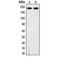 LifeSab™ VEGFR1 (pY1213) Rabbit pAb (50 µl)