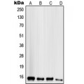 LifeSab™ Mammaglobin B Rabbit pAb (50 µl)