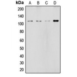 LifeSab™ NOTCH2 Rabbit pAb (50 µl)