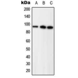 LifeSab™ Progesterone Receptor (pS294) Rabbit pAb (50 µl)