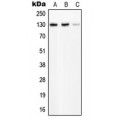 LifeSab™ PLC beta 2 Rabbit pAb (50 µl)