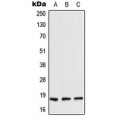 LifeSab™ TIG2 Rabbit pAb (50 µl)