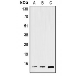 LifeSab™ Spasmolysin Rabbit pAb (50 µl)