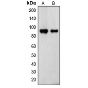 LifeSab™ Transglutaminase 2 Rabbit pAb (50 µl)