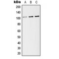 LifeSab™ CD141 Rabbit pAb (50 µl)