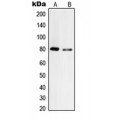 LifeSab™ Tyrosinase Rabbit pAb (50 µl)