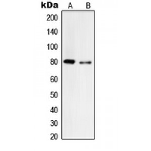 LifeSab™ Tyrosinase Rabbit pAb (50 µl)