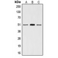 LifeSab™ VDR Rabbit pAb (50 µl)