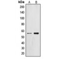 LifeSab™ ZNF187 Rabbit pAb (50 µl)