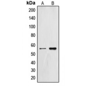 LifeSab™ ZNF187 Rabbit pAb (50 µl)