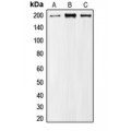 LifeSab™ MRCK alpha Rabbit pAb (50 µl)