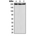 LifeSab™ MADD Rabbit pAb (50 µl)
