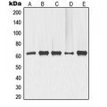 LifeSab™ p63 Rabbit pAb (50 µl)
