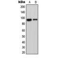 LifeSab™ ADAM23 Rabbit pAb (50 µl)