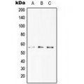 LifeSab™ DR4 Rabbit pAb (50 µl)