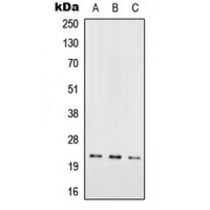 LifeSab™ RAB7L1 Rabbit pAb (50 µl)