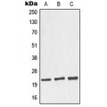 LifeSab™ Nop30 Rabbit pAb (50 µl)