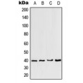 LifeSab™ CCRL2 Rabbit pAb (50 µl)