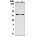 LifeSab™ DOK2 (pY299) Rabbit pAb (50 µl)