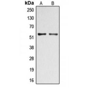 LifeSab™ DOK2 (pY299) Rabbit pAb (50 µl)
