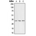 LifeSab™ CD32c Rabbit pAb (50 µl)