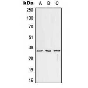 LifeSab™ CD32c Rabbit pAb (50 µl)