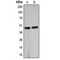 LifeSab™ B4GALT5 Rabbit pAb (50 µl)