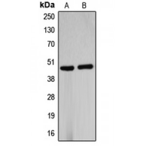 LifeSab™ B4GALT5 Rabbit pAb (50 µl)
