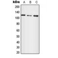LifeSab™ UBE4A Rabbit pAb (50 µl)