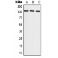 LifeSab™ RECQL4 Rabbit pAb (50 µl)