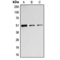 LifeSab™ BAGE5 Rabbit pAb (50 µl)