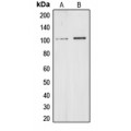 LifeSab™ CHD1L Rabbit pAb (50 µl)