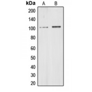 LifeSab™ CHD1L Rabbit pAb (50 µl)