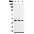 LifeSab™ MAD2L1BP Rabbit pAb (50 µl)