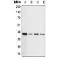 LifeSab™ MLL4 Rabbit pAb (50 µl)