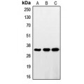 LifeSab™ RNF144A Rabbit pAb (50 µl)
