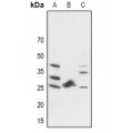 LifeSab™ FGF19 Rabbit pAb (50 µl)