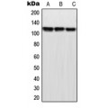 LifeSab™ MPP9 Rabbit pAb (50 µl)