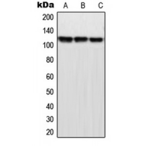 LifeSab™ MPP9 Rabbit pAb (50 µl)