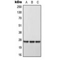 LifeSab™ DHRS2 Rabbit pAb (50 µl)