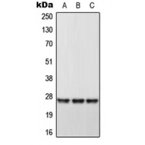 LifeSab™ DHRS2 Rabbit pAb (50 µl)