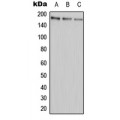 LifeSab™ ABCA9 Rabbit pAb (50 µl)