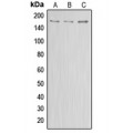 LifeSab™ ABCA8 Rabbit pAb (50 µl)