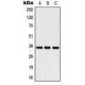 LifeSab™ Podoplanin Rabbit pAb (50 µl)