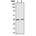 LifeSab™ CYSLTR1 Rabbit pAb (50 µl)