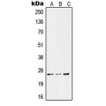 LifeSab™ Kallikrein 11 Rabbit pAb (50 µl)