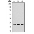 LifeSab™ CYB561D2 Rabbit pAb (50 µl)