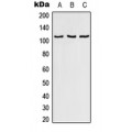 LifeSab™ RAB3GAP1 Rabbit pAb (50 µl)